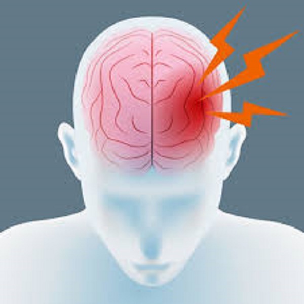 Аневризма головного мозга. Причины и симптомы