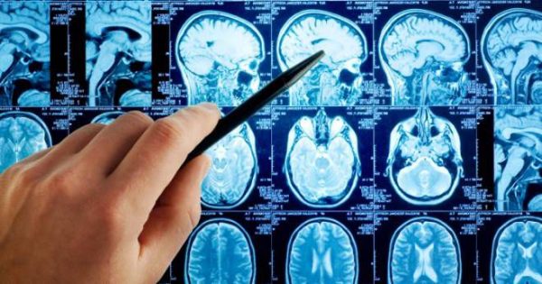 Отек головного мозга: причины появления, симптомы и диагностика