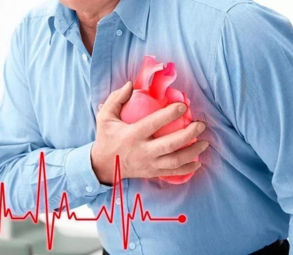 Как лечить ишемическую болезнь сердца? Запись к врачу