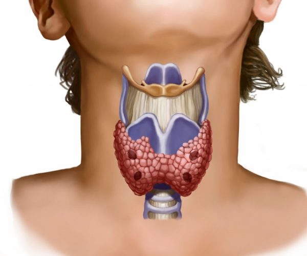 Массаж против гипотиреоза: заботимся о здоровье щитовидной железы