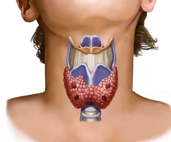 Эти сигналы указывают на патологию щитовидной железы